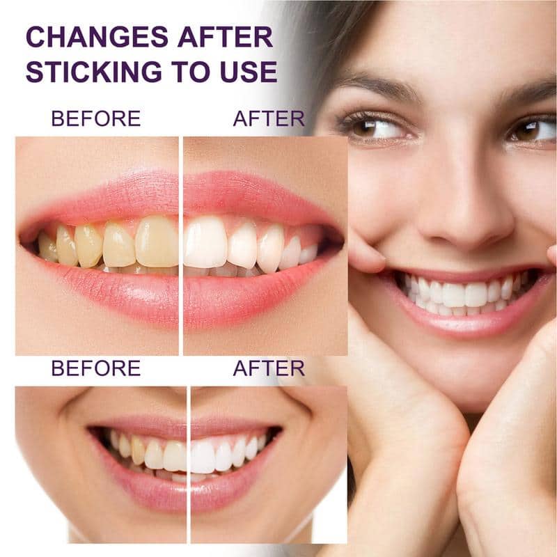 Dentifrice pour le blanchiment des dents, correcteur de couleur, élimine les taches, 50ml - Soins et Beauté - صورة 4