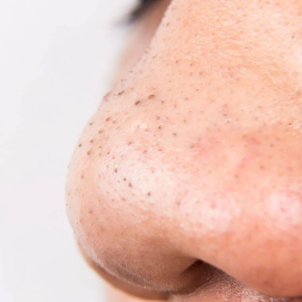 Appareil de Points Noirs avec 5 têtes d’aspiration – جهاز شفط الرؤوس السوداء لتنظيف البشرة - Soins et Beauté - صورة 6