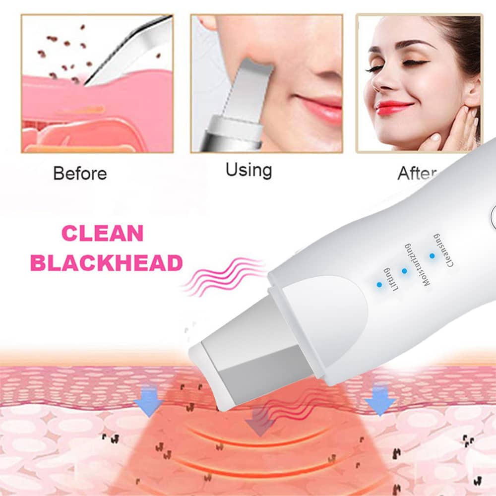 Appareil Ultrasonic purificateur points noir 3en1 lifting-8815 - Soins et Beauté - صورة 4