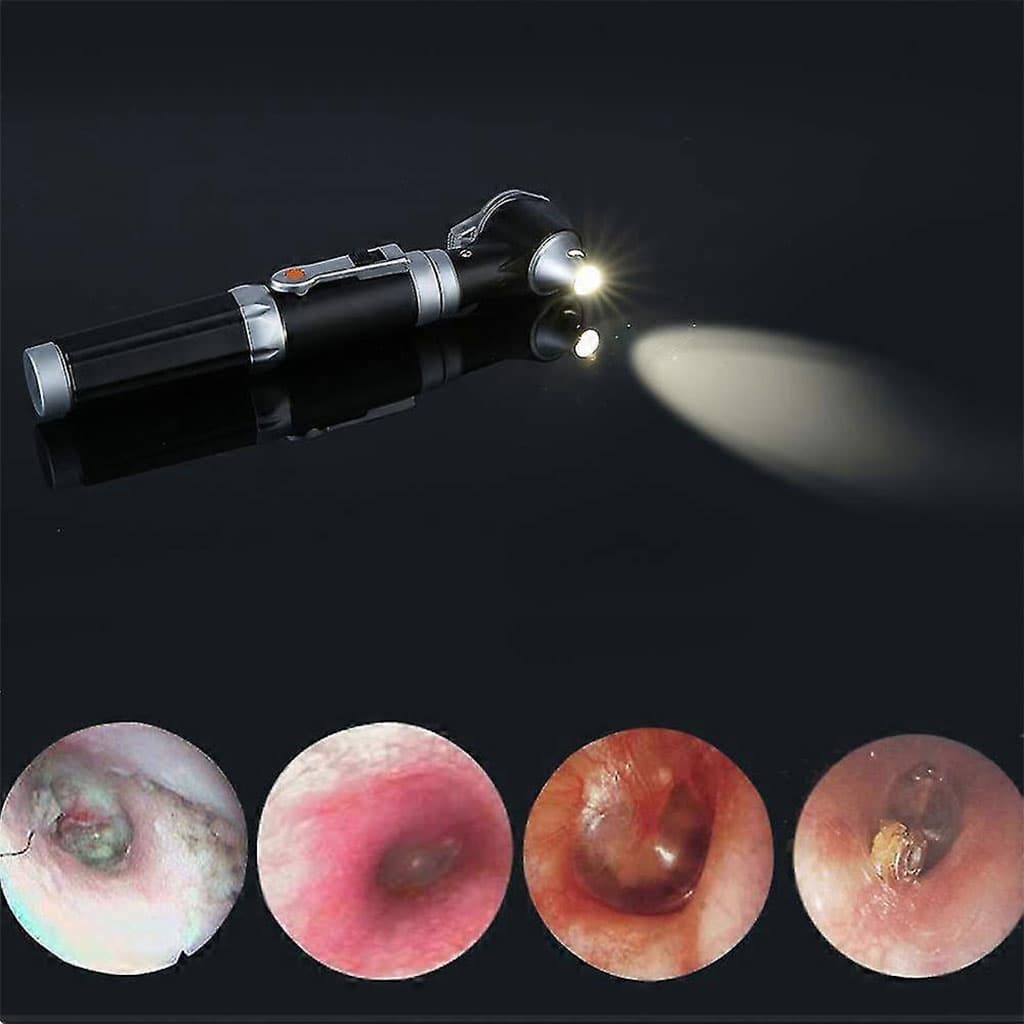 Otoscope 3X avec LED loupe de contrôle d’oreille portable avec 8 capuchons – جهاز فحص الأذن - Soins et Beauté - صورة 3