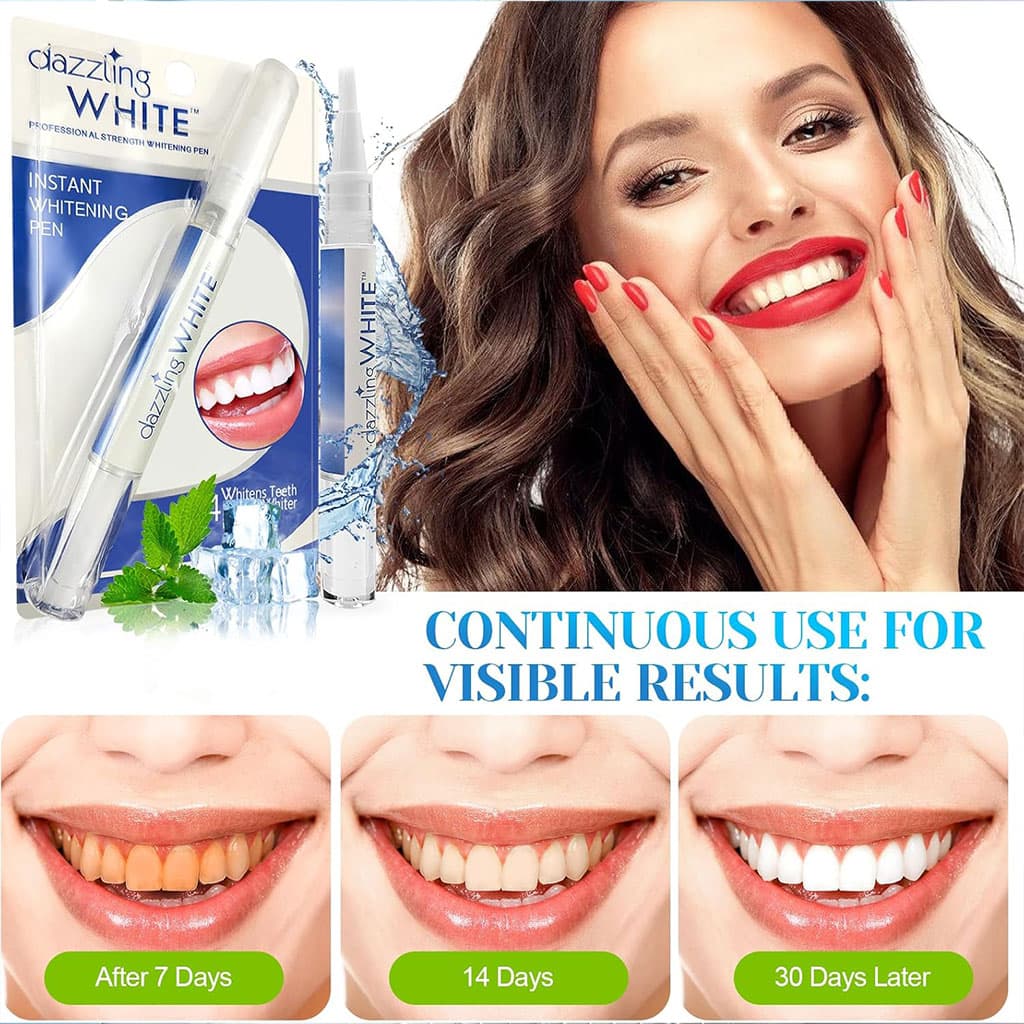 Stylo blanchissant pour les dents en 2 parties avec applicateur doux - Soins et Beauté - صورة 4