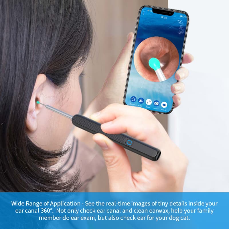 Kit de nettoyage des oreilles intelligents sans fil avec caméra et lumière LED NE3 — صورة 2