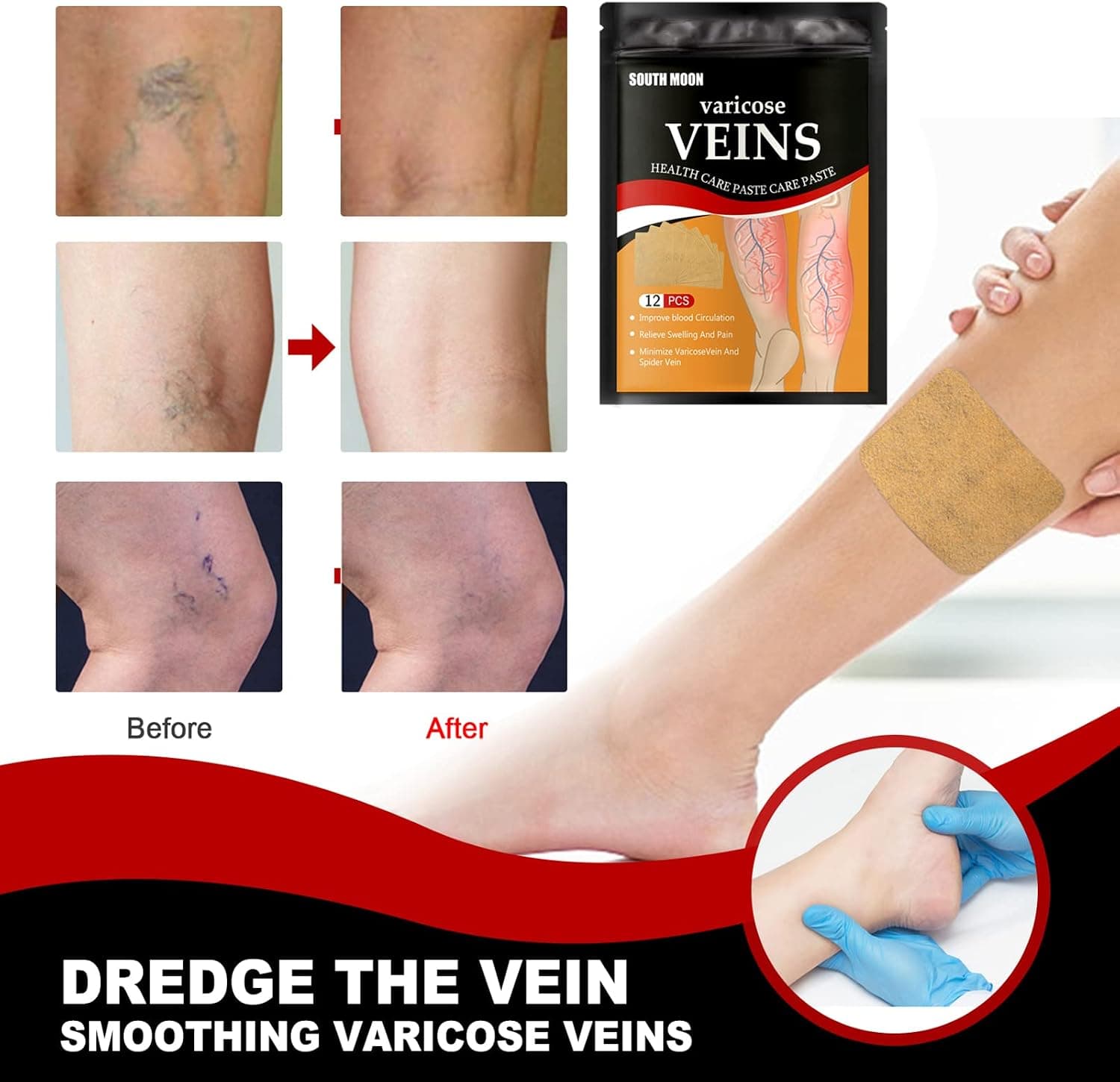 Patchs Herbales Anti-Varices Soulagement Douleur, Amélioration Circulation 12Pcs - لاصقات الأعشاب الطبيعية لعلاج الدوالي والدورة الدموية - Divers - صورة 2