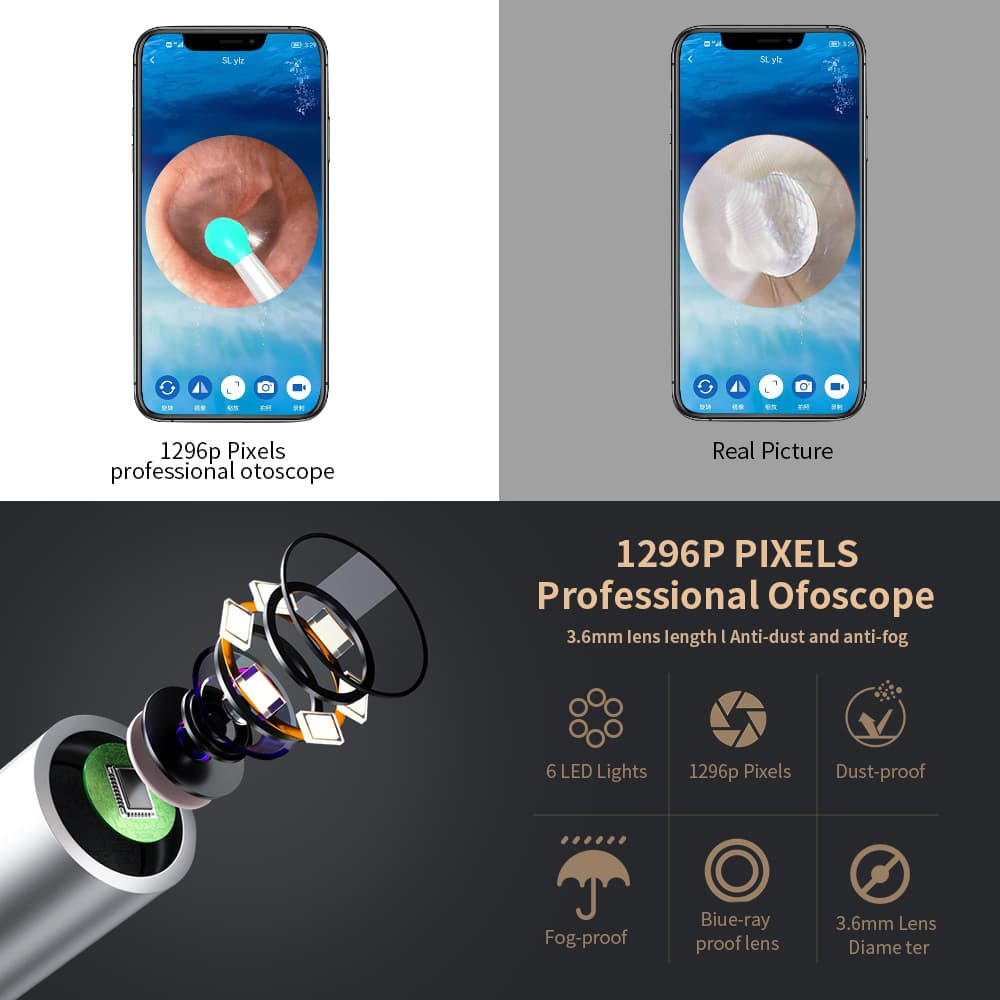 Kit de nettoyage des oreilles intelligents sans fil avec caméra et lumière LED NE3 - Électronique - صورة 5