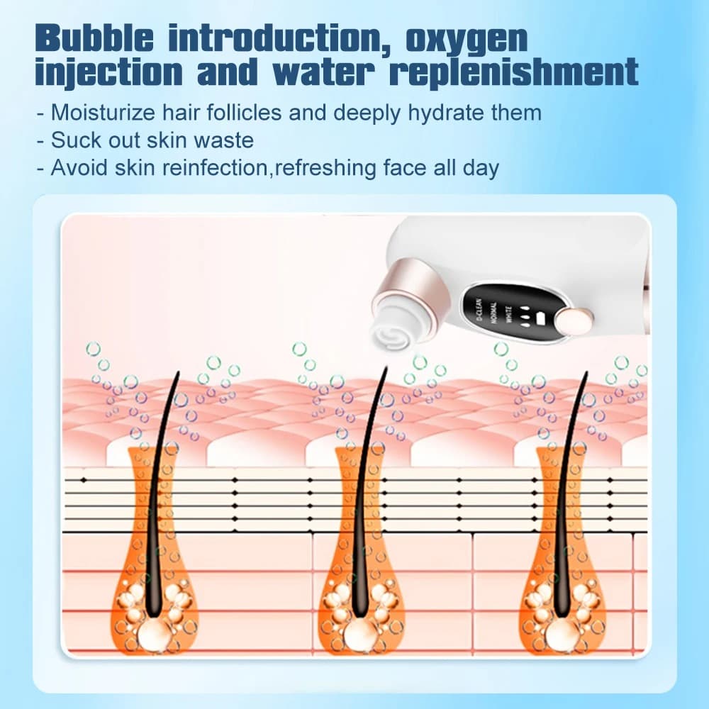 Aspirateur de Point Noirs avec 6 têtes d’aspiration et 3 modes – جهاز إزالة الرؤوس السوداء - Soins et Beauté - صورة 5