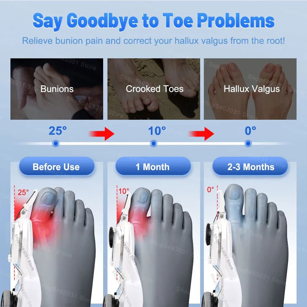 Correcteur Hallux Valgus pour Femme et Homme avec Molette Réglable – مصحح وضعية القدم - Soins et Beauté - صورة 4
