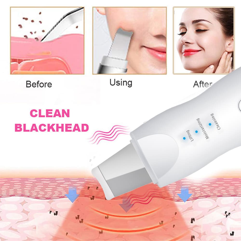 Appareil Ultrasonic purificateur points noir 3en1 lifting-8815 - Soins et Beauté - صورة 4