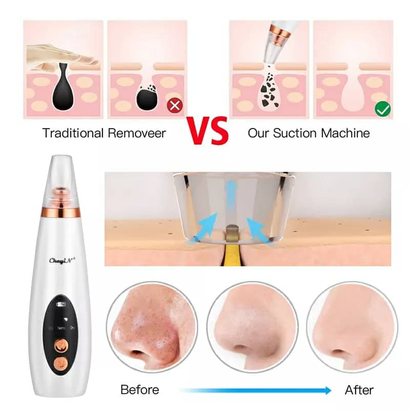 Aspirateur De Graisse De Visage Performant — صورة 5